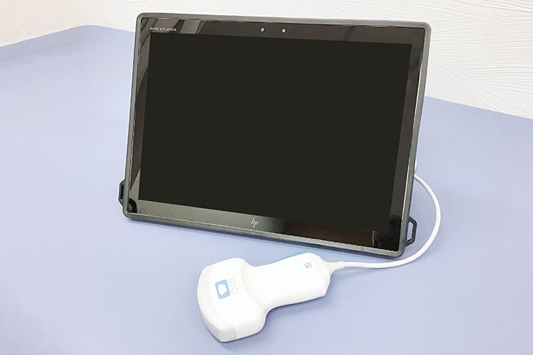 超音波画像診断装置